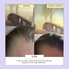 Scalp + Hair Oil with Bacuri Butter + Castor Oil