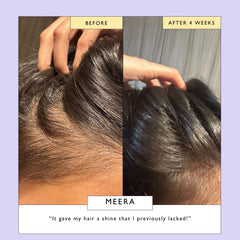Scalp + Hair Oil with Bacuri Butter + Castor Oil
