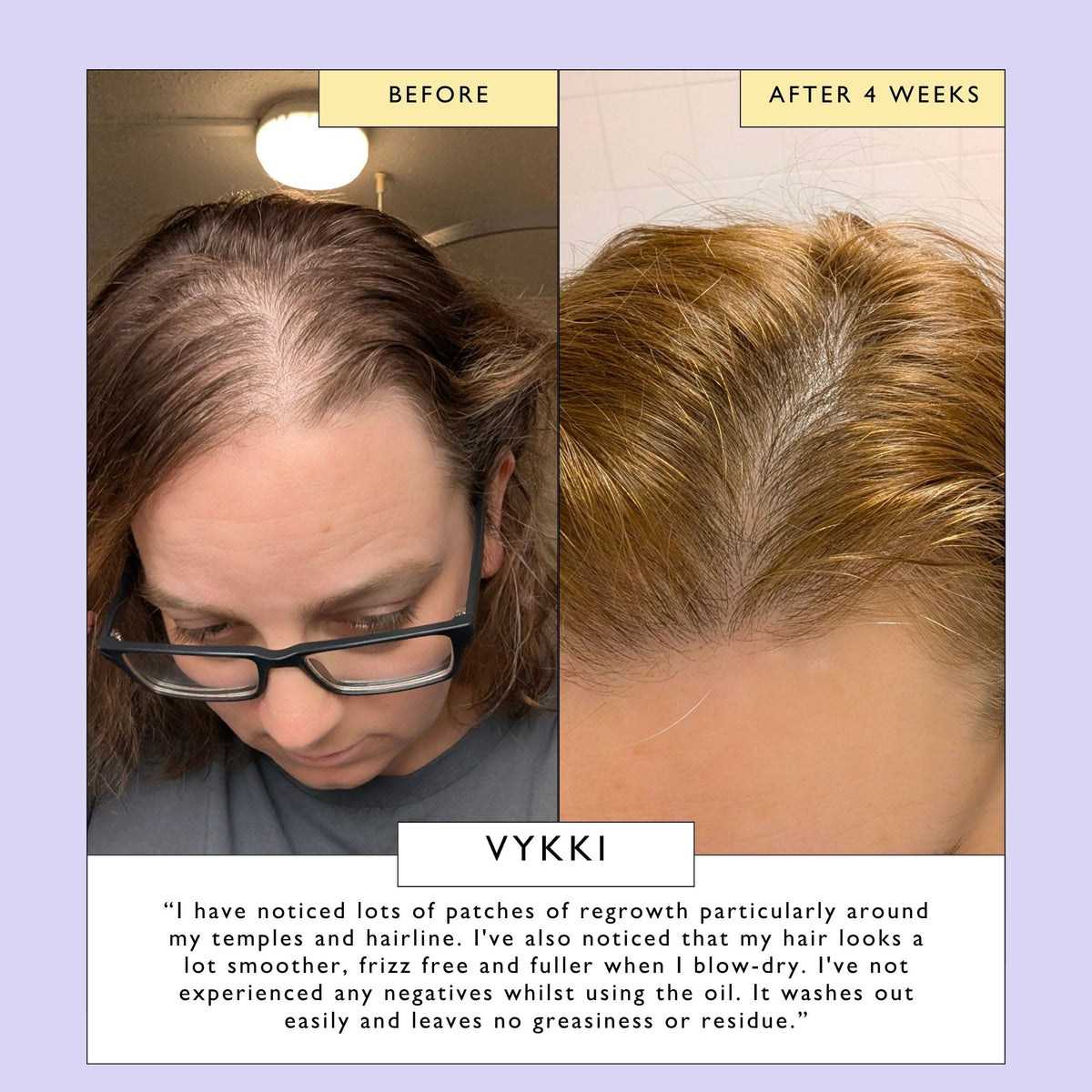 Scalp + Hair Oil with Bacuri Butter + Castor Oil